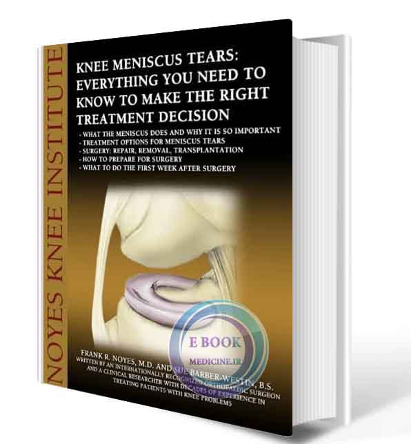 دانلود کتاب  Knee Meniscus (Cartilage) Tears: Everything You Need to Know to Make the Right Treatment Decision  (ORIGINAL PDF)